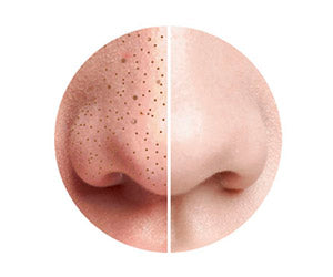 Vacu Clear a 248 LEU